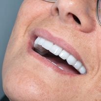 Slider image (10) Turkiye Dental